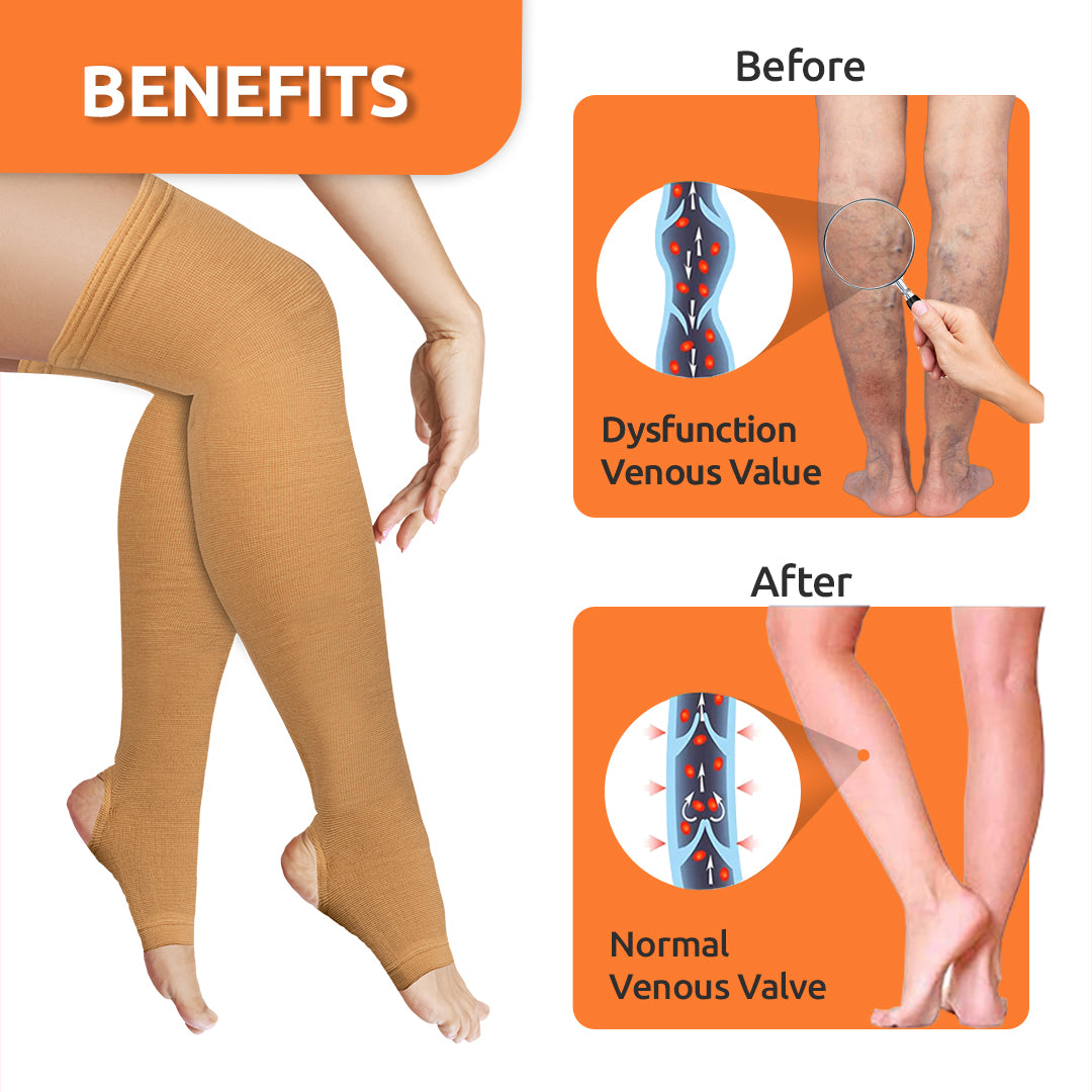 Buy SHASHICO Compression Varicose Vein Stockings - L Online at Best Prices  in India - JioMart.