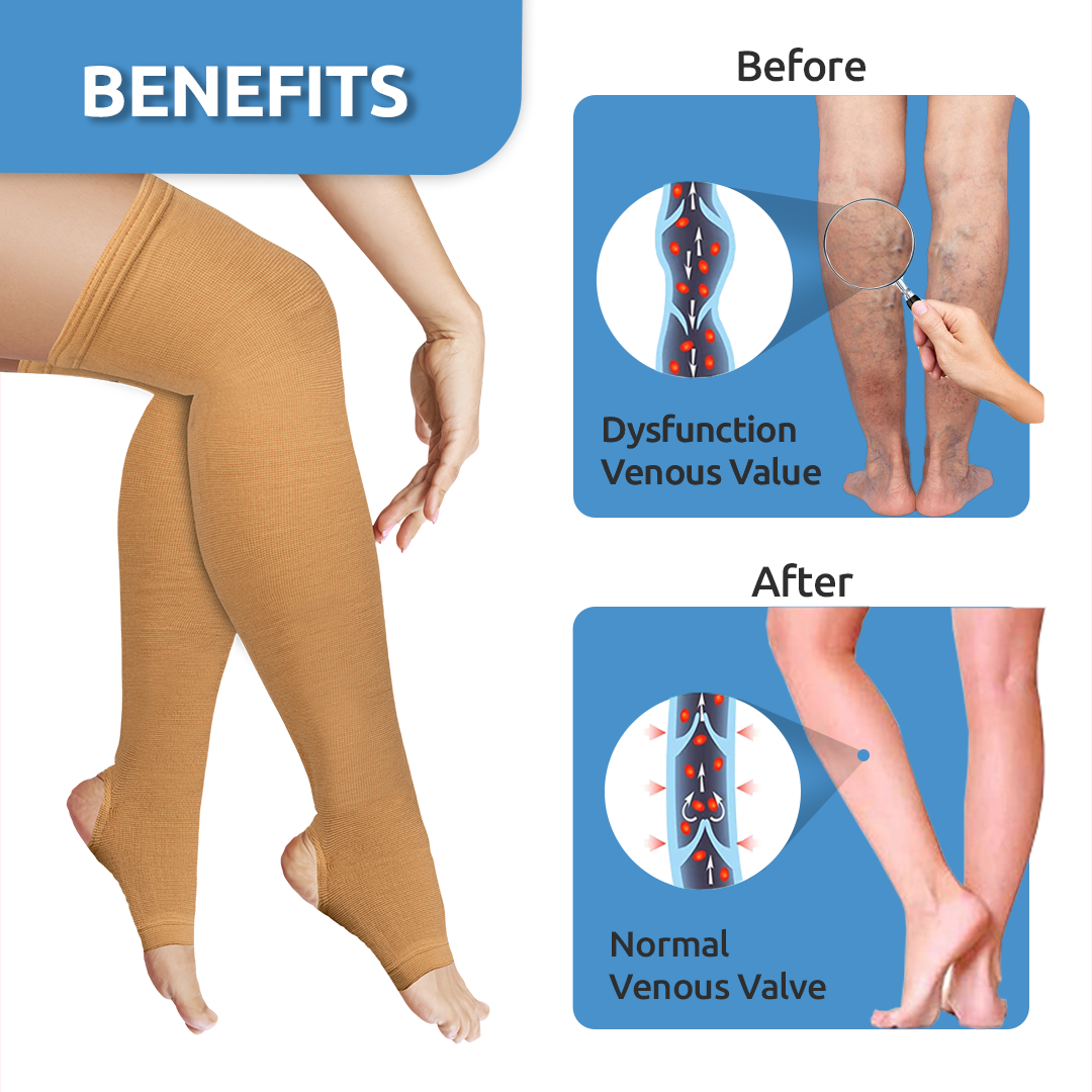 Vissco Varicose Vein Stockings