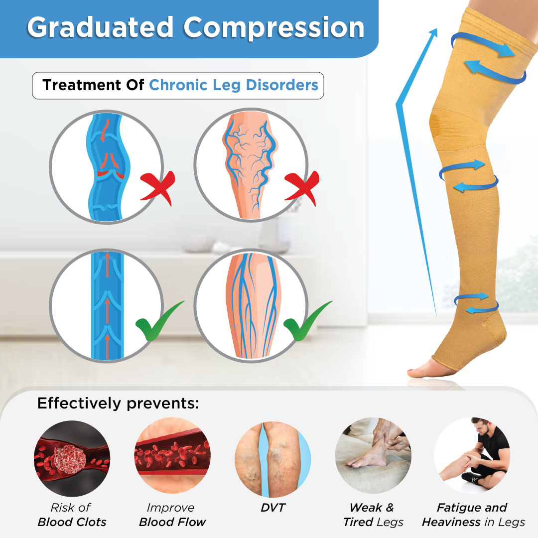 Vissco Medical Compression Stockings - Above Knee