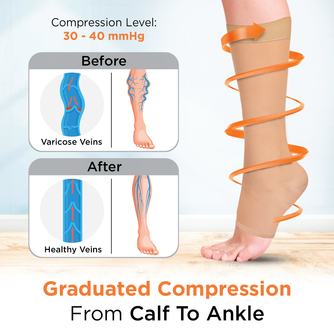 Class 2 Knee Length Graduated Compression Stockings – Technomed
