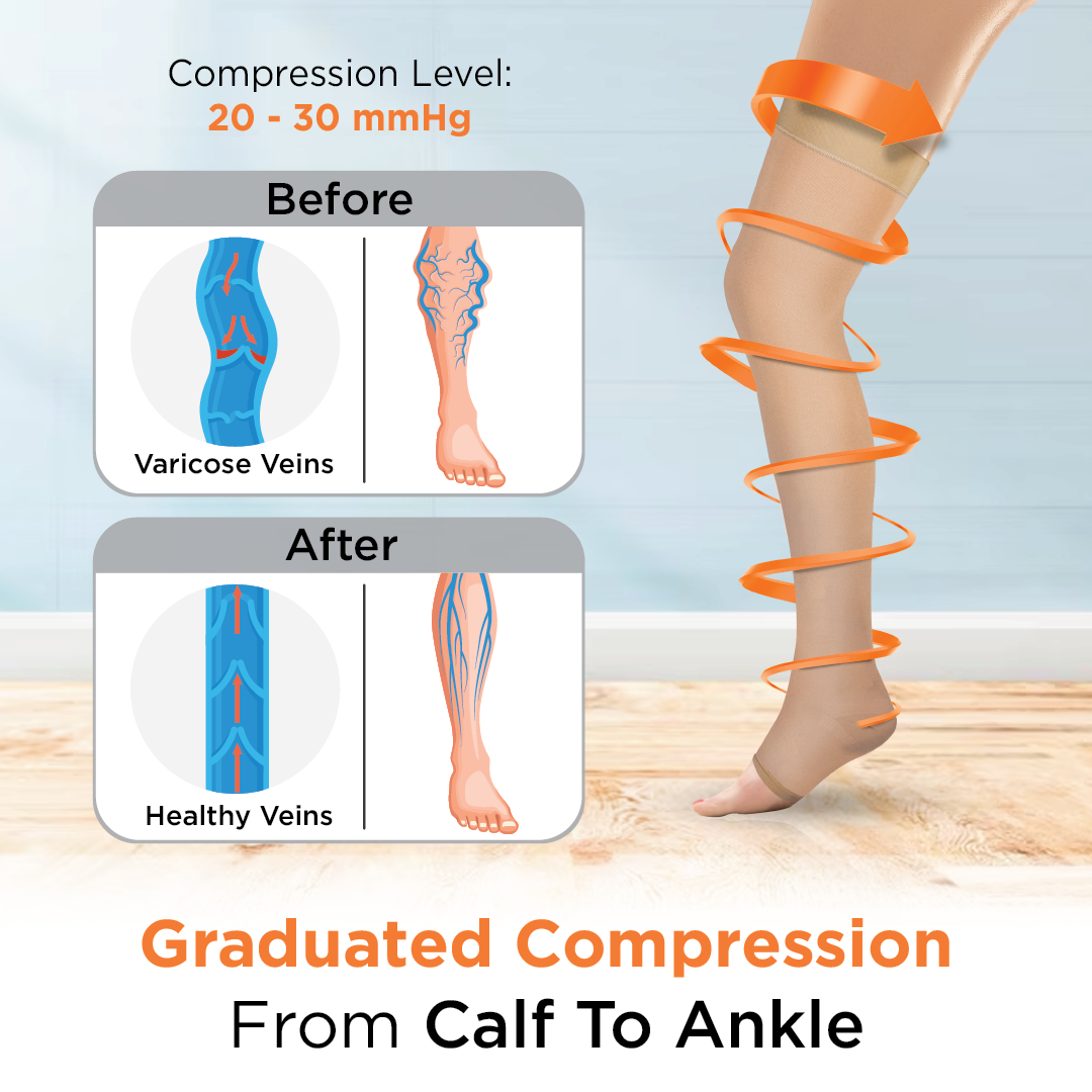 Medical Compression - Class 2 Thigh Length|Mild Support | Improves Blood Circulation | Swollen | Tired | Aching Legs  (Beige)